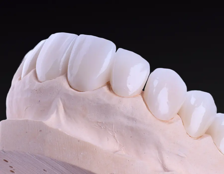 Planejamento digital do sorriso - Dr. Reinaldo Antonucci